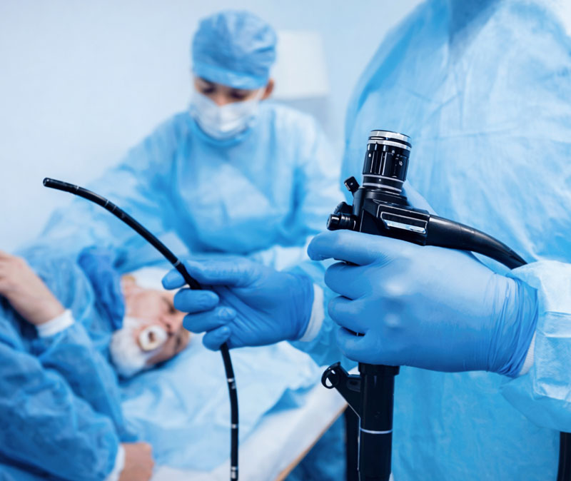 Advanced Endoscopy