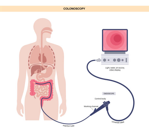 Best Colonscopy Test in Kopar Khairane